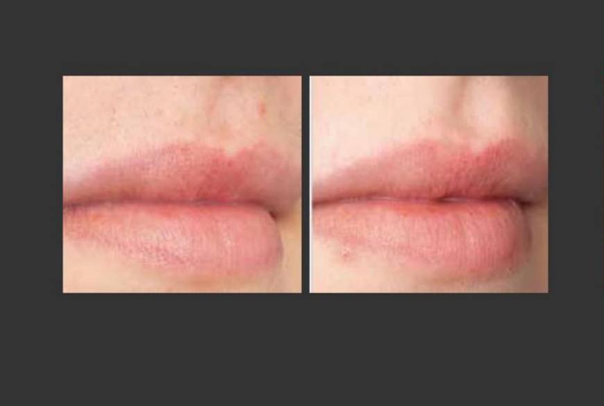 Lippee