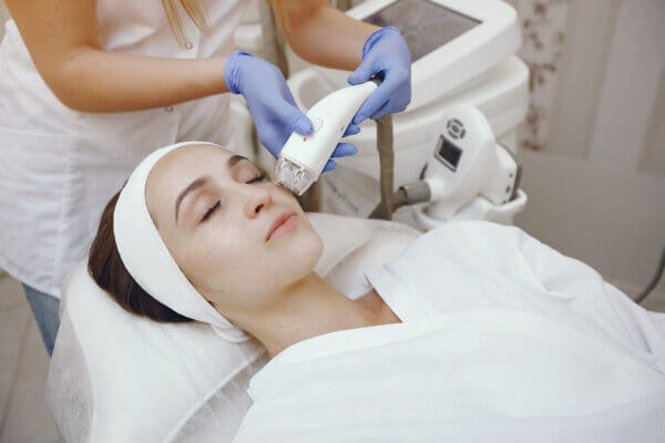 Frau bei RF-Microneedling im Gesicht